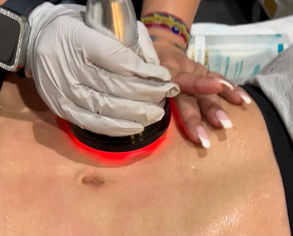 DermaPlane
