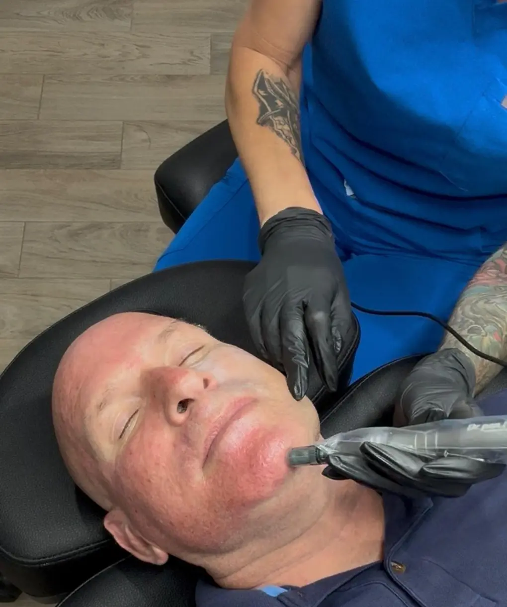 Radiofrequency