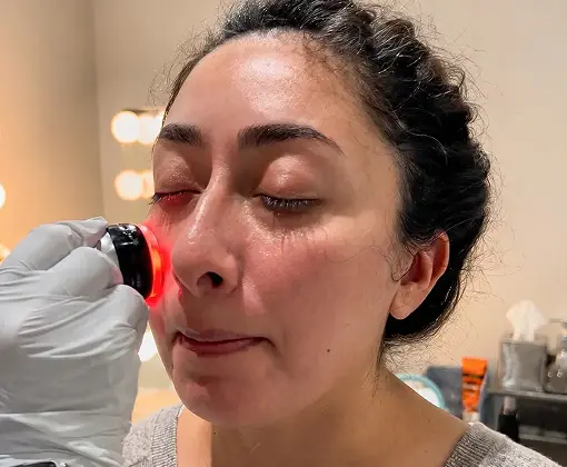 DermaPlane